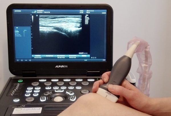 Alaraajojen ultraäänikuvaus
